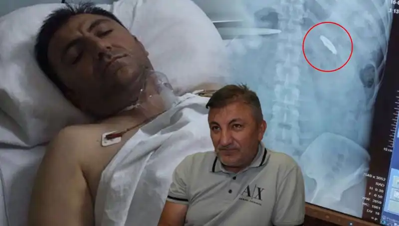 15 Temmuz Gece’sinin Acı Mirası: Vücudunda Kurşunla Yaşayan Kahraman