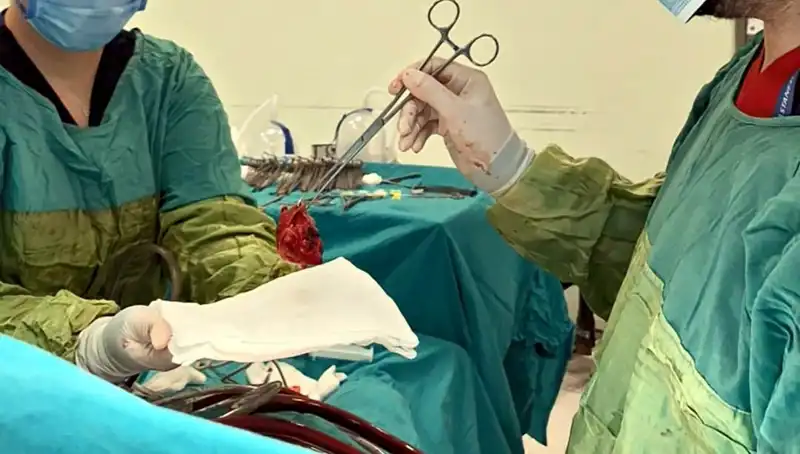 Kalp Kapağı Çürüyen Hastaya 7 Saatlik Ameliyat: "Mucizevi Bir Başarı"