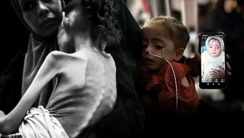 Küçük Meryem’in Mücadelesi: 25 Kilodan 10 Kiloya Düşüşün Ardındaki Acı Gerçekler
